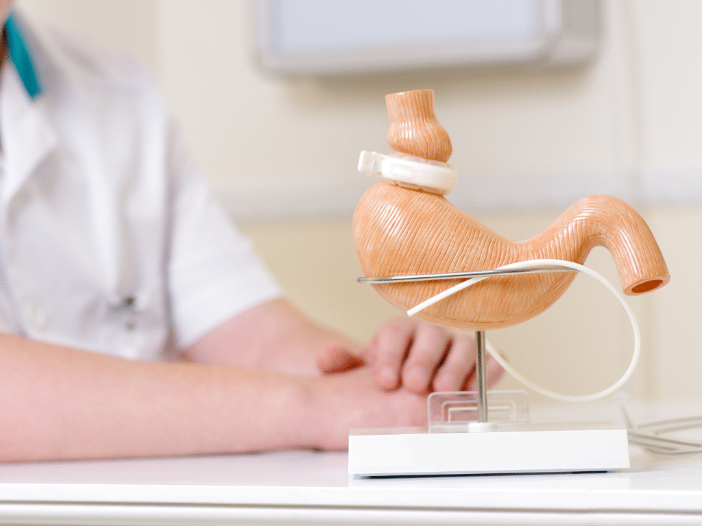 model van een maag met maagband op standaard bij arts op tafel